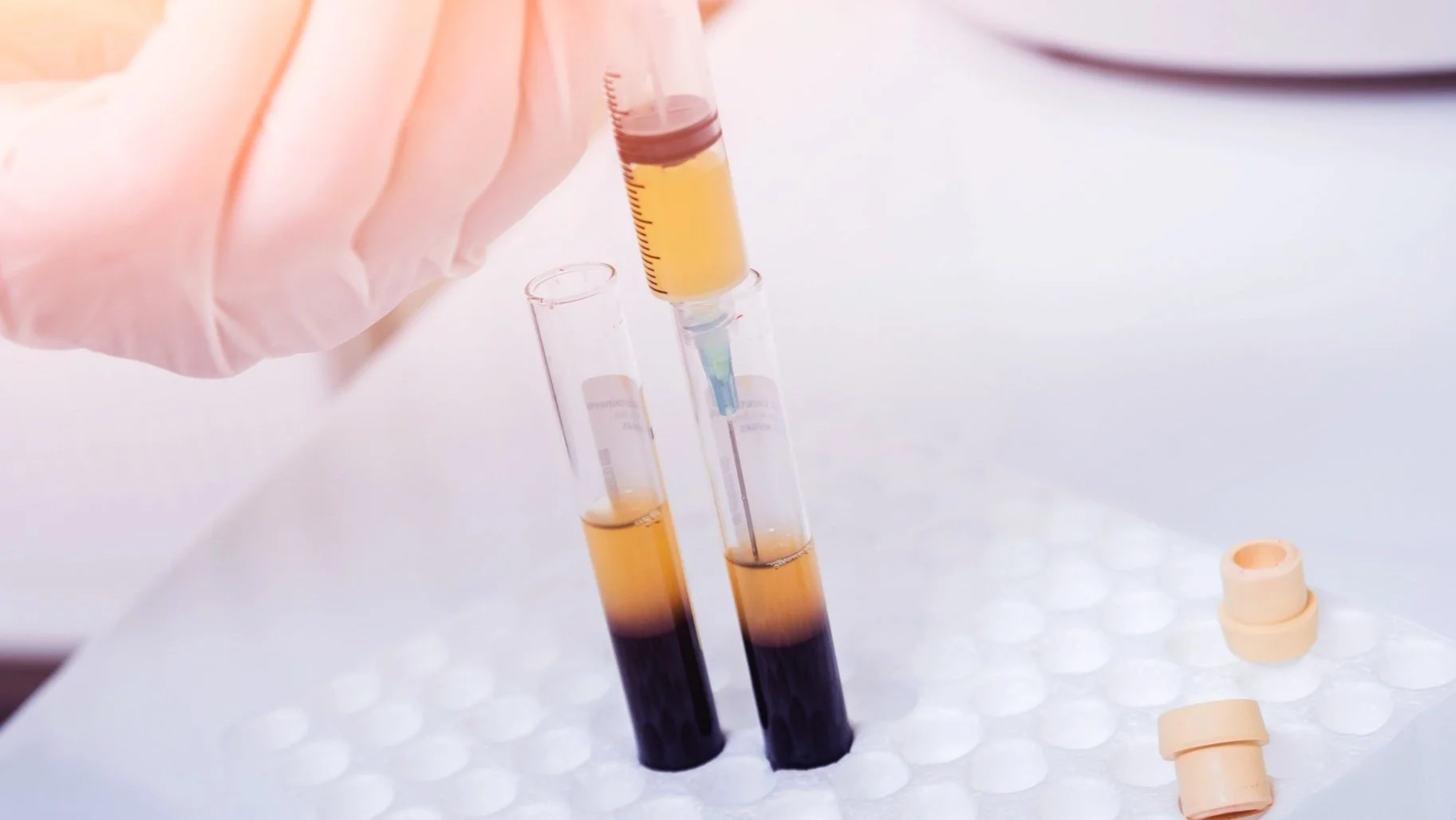 Injection Therapy