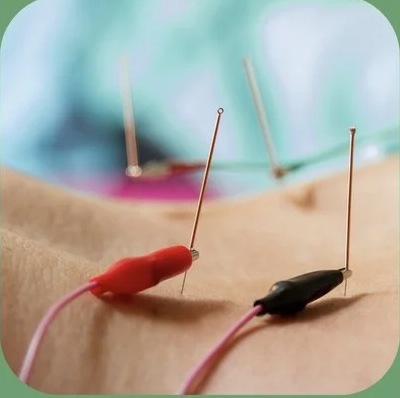 Acupuncture & Integrative Care